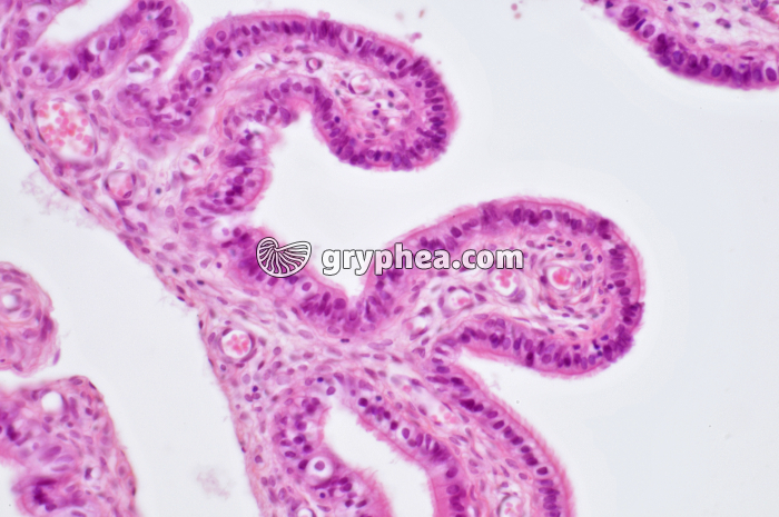 Trompe de Fallope x100 - gryphea.com